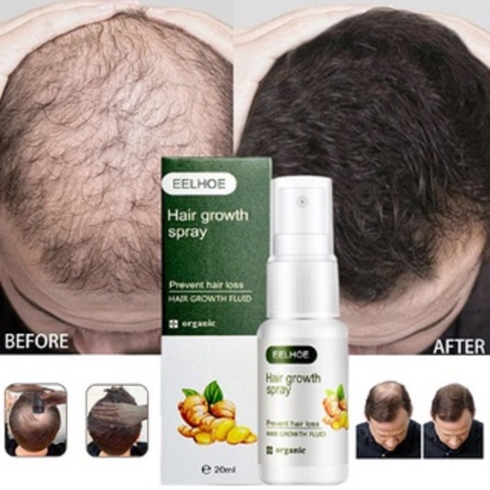 Eelhoe Red Onion Shampoo Black Seed Oil Hair Care Shampoo Hair Care Cleansing Scalp Refreshing Shampoo Hair Care Oil